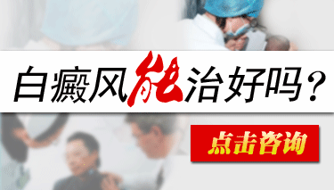粡ӦЩʳ