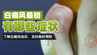 南京白癜风国家正规医院