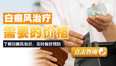ϾưǮ