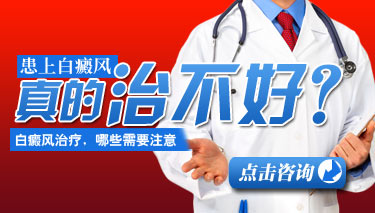 Ͼưշ