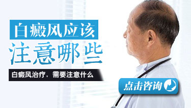 粡Ҫעʲô