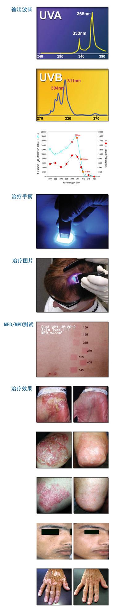 Dnalight,UVAUVB120ٴٴϵͳ.jpg